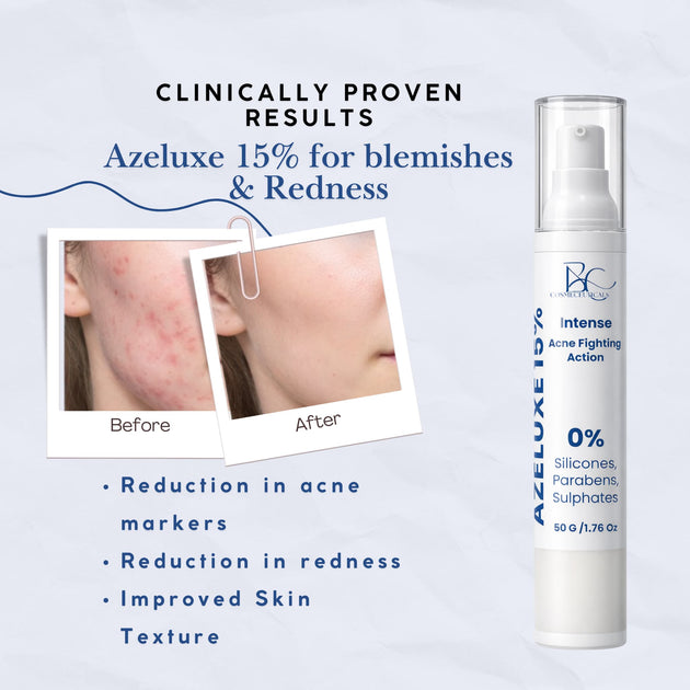Azelaic Acid 15% Acne Treatment Serum – Azeluxe BC Cosmeceuticals Blemish Control and Redness Correcting Face Serum with before and after treatment images and effects listed reduce acne markers, redness and improve skin texture
